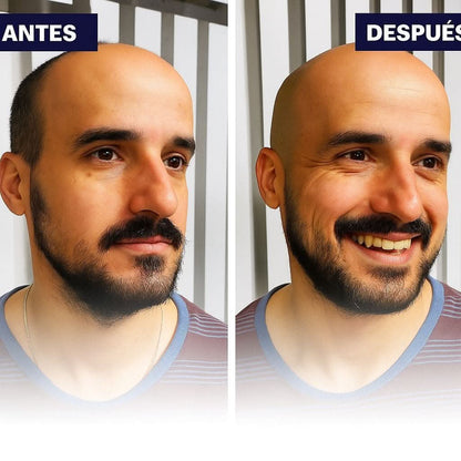 ToroBlade Pro - MercaPro